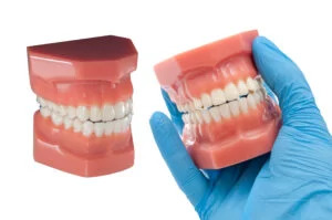 A mock set of teeth's 