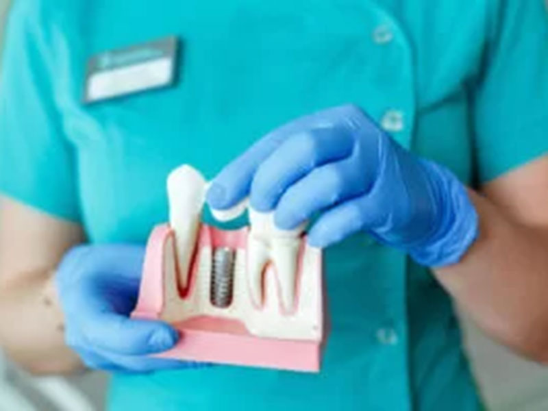 teeth in doctor hand