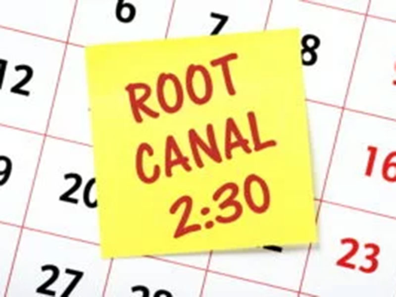 root canal calender