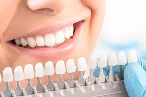 teeth whitening artificial